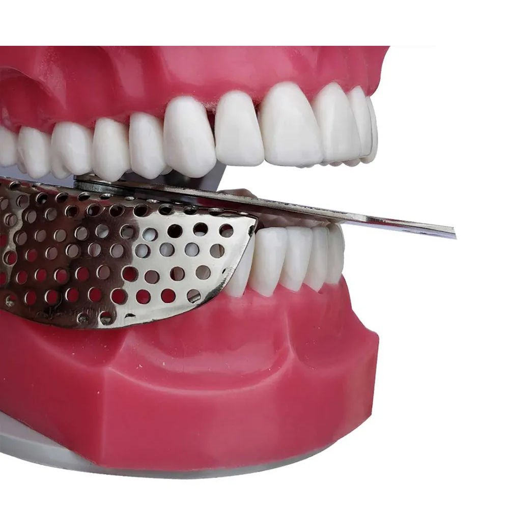 GDC Impression Trays Half Right # 1 (Itrldphr1)